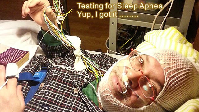 sleep-apnea-2014